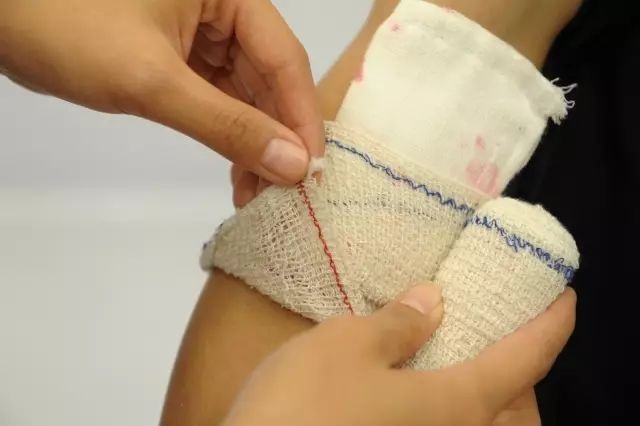 螺旋包扎法1 螺旋包扎法1